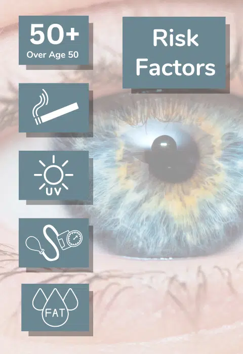 Infographic of AMD Risk Factors