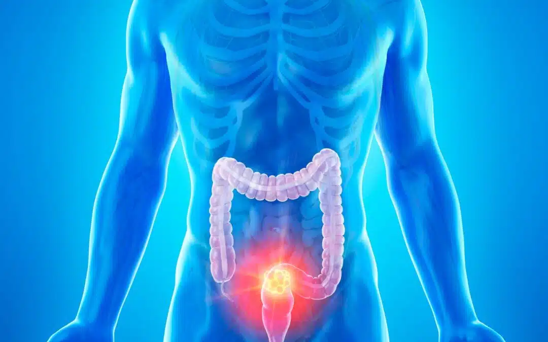 Colorectal Cancer Screenings