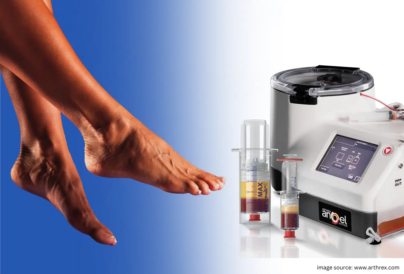 Advanced Healing for Foot & Ankle Pain