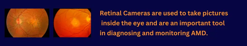 Retinal Images from Fundus Photography Machine.