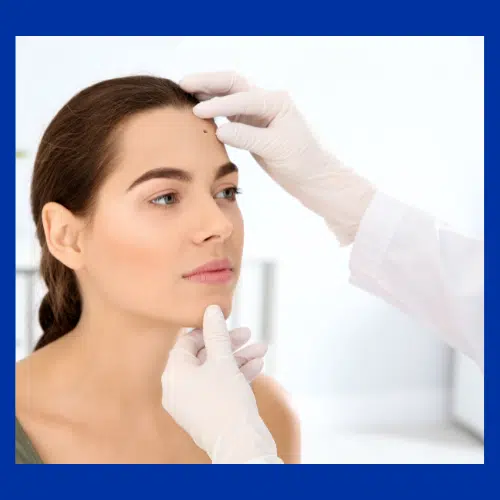 Primary Care physician evaluating a mole.